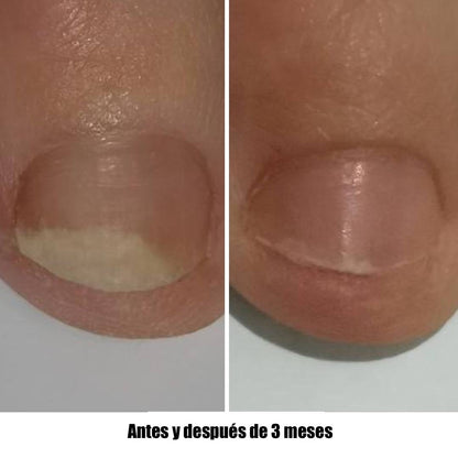 NAILSOFTHEDAY Onistop. Aceite de cuidado intensivo para uñas y cutículas